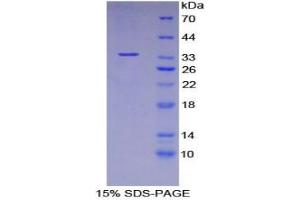 SDS-PAGE analysis of Human ASM Protein. (SMPD1 Protein)