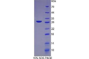 SDS-PAGE analysis of Rat C-Reactive Protein. (CRP Protein)