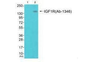 Western blot analysis of extracts from 293 cells (Lane 2), using IGF1R (Ab-1346) antiobdy. (IGF1R antibody  (Tyr1346))