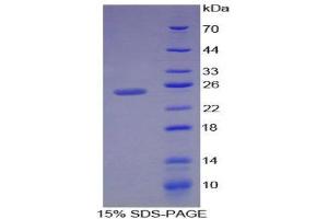 SDS-PAGE (SDS) image for Vitamin D-Binding Protein (GC) (AA 209-401) protein (His tag) (ABIN2127234)