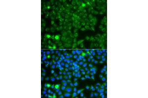 Immunofluorescence analysis of A549 cell using GBA3 antibody. (GBA3 antibody)