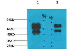 Western Blot (WB) analysis of 1) Mouse Brain Tissue, 2)Rat Brain Tissue with GABA A Receptor gamma2 Rabbit Polyclonal Antibody diluted at 1:2000. (GABRG2 antibody)