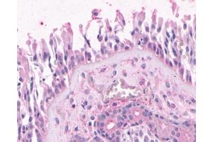 Immunohistochemical staining of Nasal Mucosa (Respiratory Epithelium) using anti- OR2A4 antibody ABIN122516