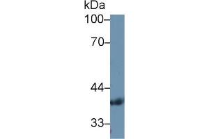 Western Blot; Sample: Human Serum; Primary Ab: 1µg/ml Rabbit Anti-Human PDHb Antibody Second Ab: 0. (PDHB antibody  (AA 31-341))