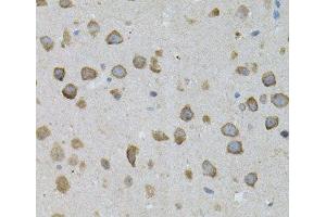 Immunohistochemistry of paraffin-embedded Mouse brain using ASAH2 Polyclonal Antibody (ASAH2 antibody)
