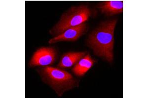 Immunofluorescence of human A549 cells stained with Hoechst 33342 (Blue) and monoclonal anti-human FUS2 antibody (1:500) with Texas Red (red). (FUS2/NAA80 (AA 1-308) antibody)