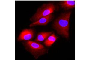 Immunofluorescence of human A549 cells stained with Hoechst 33342 (Blue) and monoclonal anti-human FUS2 antibody (1:500) with Texas Red (red).