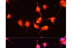 Immunofluorescence analysis of U-251MG cells using NGF Polyclonal Antibody at dilution of 1:100 (40x lens). (Nerve Growth Factor antibody)