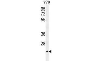 TCAL3 Antibody (N-term) western blot analysis in Y79 cell line lysates (35 µg/lane). (TCEAL3 antibody  (N-Term))