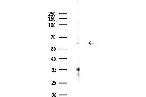Western blot analysis of lysates from COLO205 cells(heat-shock,45 min treatment), using RIPK2 Antibody at 1/1000 dilution.
