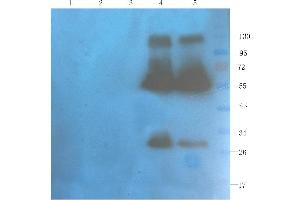 Western Blot using anti-OX40L antibody  Rat spleen (lane 1), rat muscle (lane 2), rat bladder (lane 3), human breast tumour (lane 4) and human thyroid tumour (lane 5) samples were resolved on a 10% SDS PAGE gel and blots probed with  at 1 µg/ml before being detected by a secondary antibody. (Recombinant CD40L (Ruplizumab Biosimilar) antibody)