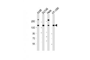 Western Blot at 1:1000 dilution Lane 1: A549 whole cell lysate Lane 2: DU145 whole cell lysate Lane 3: Hela whole cell lysate Lane 4: HT-1080 whole cell lysate Lysates/proteins at 20 ug per lane.