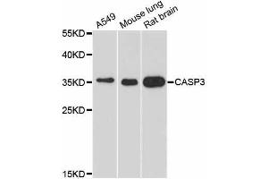 Western blot analysis of extracts of various cell lines, using CASP3 antibody. (Caspase 3 antibody  (AA 100-200))