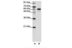 Image no. 1 for anti-Cas-Br-M (Murine) Ecotropic Retroviral Transforming Sequence-Like 1 (CBLL1) (C-Term) antibody (ABIN202651) (CBLL1 antibody  (C-Term))