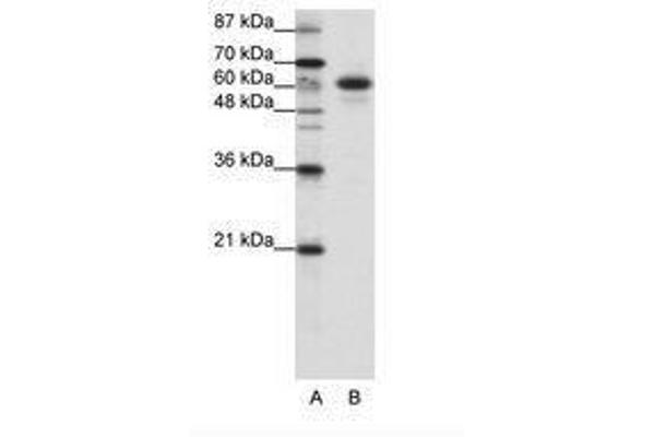 CBLL1 antibody  (C-Term)