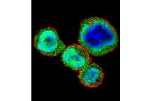 Confocal immunofluorescent analysis of RB1 Antibody  (ABIN1881730 and ABIN2840685) with MDA-M cell followed by Alexa Fluor 488-conjugated goat anti-rabbit lgG (green). (Retinoblastoma 1 antibody  (AA 586-615))