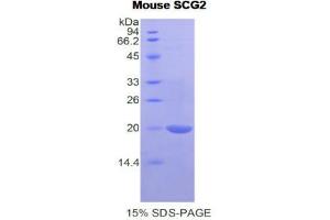 SDS-PAGE (SDS) image for Secretogranin II (SCG2) (AA 430-586) protein (His tag) (ABIN1878212) (SCG2 Protein (AA 430-586) (His tag))