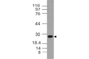 Image no. 1 for anti-14-3-3 theta (YWHAQ) antibody (ABIN5027747) (14-3-3 theta antibody)