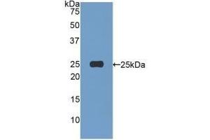 Detection of Recombinant AFM, Human using Polyclonal Antibody to Afamin (AFM) (Afamin antibody  (AA 22-210))