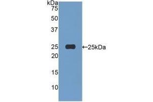 Afamin anticorps  (AA 22-210)