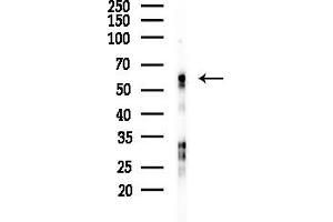 Western blot analysis of lysates from LoVo cells(heat-shock,45 min treatment), using Adrenergic Receptor alpha -2C Antibody at 1/1000 dilution.