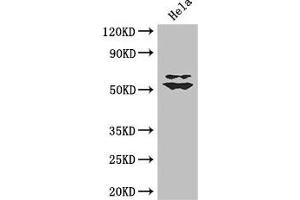 Western Blot Positive WB detected in: Hela whole cell lysate All lanes: KLF5 antibody at 3 μg/mL Secondary Goat polyclonal to rabbit IgG at 1/50000 dilution Predicted band size: 51, 34, 19, 42 kDa Observed band size: 51, 60 kDa (KLF5 antibody  (AA 69-346))