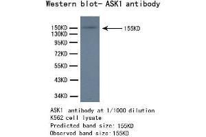 Western Blotting (WB) image for anti-Mitogen-Activated Protein Kinase Kinase Kinase 5 (MAP3K5) antibody (ABIN1873617) (ASK1 antibody)