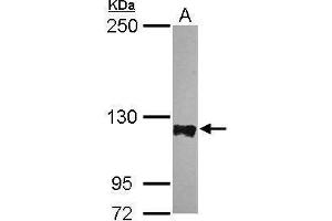 WB Image Sample (30 ug of whole cell lysate) A: HeLa 5% SDS PAGE antibody diluted at 1:5000