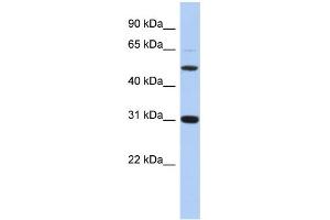 WB Suggested Anti-PI16 Antibody Titration: 0.