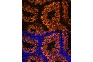 Immunofluorescence analysis of mouse testis using LDHC Polyclonal Antibody (ABIN7268172) at dilution of 1:100 (40x lens). (Lactate Dehydrogenase C antibody  (AA 150-250))