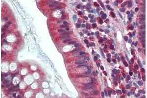 Human Small Intestine: Formalin-Fixed, Paraffin-Embedded (FFPE) (CA1 antibody  (AA 166-176))