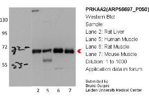 Western Blotting (WB) image for anti-Protein Kinase, AMP-Activated, alpha 2 Catalytic Subunit (PRKAA2) (Middle Region) antibody (ABIN2786849) (PRKAA2 antibody  (Middle Region))
