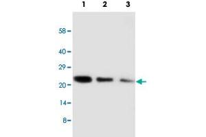 Western blot analysis of CDC42 recombinant protein with CDC42 polyclonal antibody . (CDC42 antibody  (Internal Region))