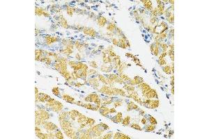 Immunohistochemistry of paraffin-embedded human stomach using HSPA9 antibody.