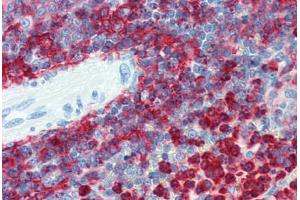 Spleen, Human: Formalin-Fixed, Paraffin-Embedded (FFPE) (Integrin beta 2 antibody  (AA 534-546))