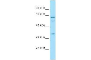 WB Suggested Anti-RAD51D Antibody Titration: 1. (RAD51D antibody  (C-Term))