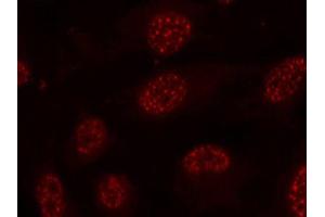 Immunofluorescence staining of methanol-fixed HeLa cells using Phospho-MAPKAPK2-T334 antibody (ABIN2988148). (MAPKAP Kinase 2 antibody  (pThr334))