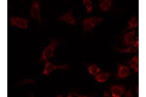 ABIN6274734 staining Hela by IF/ICC. (MRPL20 antibody  (C-Term))