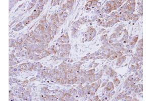 IHC-P Image Immunohistochemical analysis of paraffin-embedded SG xenograft , using BHMT, antibody at 1:100 dilution. (BHMT antibody)
