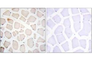 Immunohistochemistry analysis of paraffin-embedded human skeletal muscle tissue, using Clock Antibody. (CLOCK antibody  (AA 241-290))