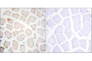 Immunohistochemistry analysis of paraffin-embedded human skeletal muscle tissue, using Clock Antibody.