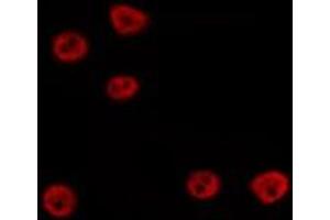 ABIN6275741 staining Hela by IF/ICC. (TEAD3 antibody  (Internal Region))