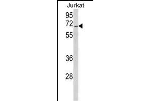 Western blot analysis of RBM14 Antibody (Center) (ABIN650783 and ABIN2839556) in Jurkat cell line lysates (35 μg/lane). (RBM14 antibody  (AA 193-223))