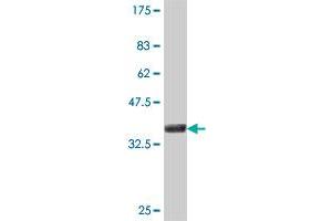 Western Blot detection against Immunogen (36. (HLA-DOB antibody  (AA 27-116))