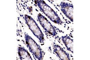 Immunohistochemistry of paraffin embedded human colon using ANKK1 (ABIN7073056) at dilution of 1:200 (400x lens) (ANKK1 antibody)