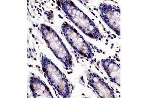 Immunohistochemistry of paraffin embedded human colon using ANKK1 (ABIN7073056) at dilution of 1:200 (400x lens) (ANKK1 antibody)