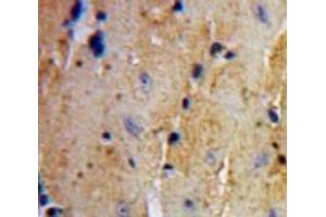 IHC-P analysis of Heart tissue, with DAB staining. (UCHL3 antibody  (C-Term))
