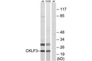 Western Blotting (WB) image for anti-CKLF-Like MARVEL Transmembrane Domain Containing 3 (CMTM3) (AA 1-50) antibody (ABIN2890221) (CMTM3 antibody  (AA 1-50))