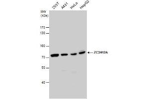 WB Image ZC3H12A antibody detects ZC3H12A protein by western blot analysis. (ZC3H12A antibody)