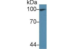 Detection of TNPO1 in Human 293T cell lysate using Polyclonal Antibody to Transportin 1 (TNPO1) (Transportin 1 antibody  (AA 593-836))